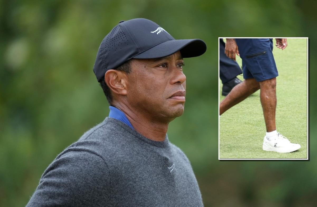 SHOCKING 😳 Tiger Woods showed off his right leg scar for the first time since his 2021 car crash, and it is absolutely gnarly. Full details below ⬇️